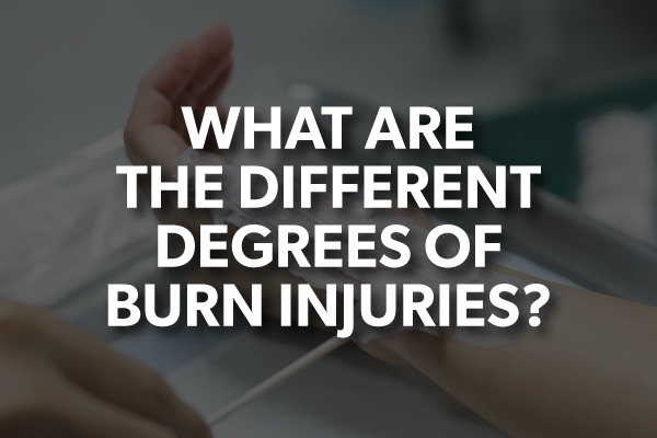 A person treating a burn with the words, "what are the different degrees of burn injuries?"